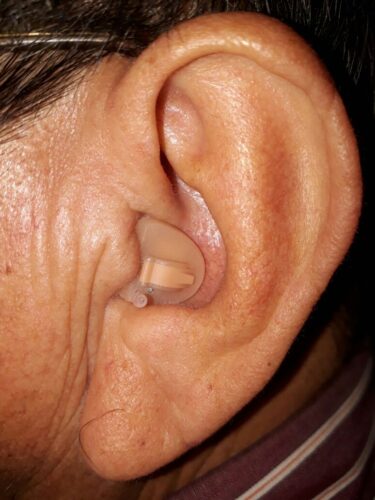 Audífonos Medicados para sordera Modelo Intracanal